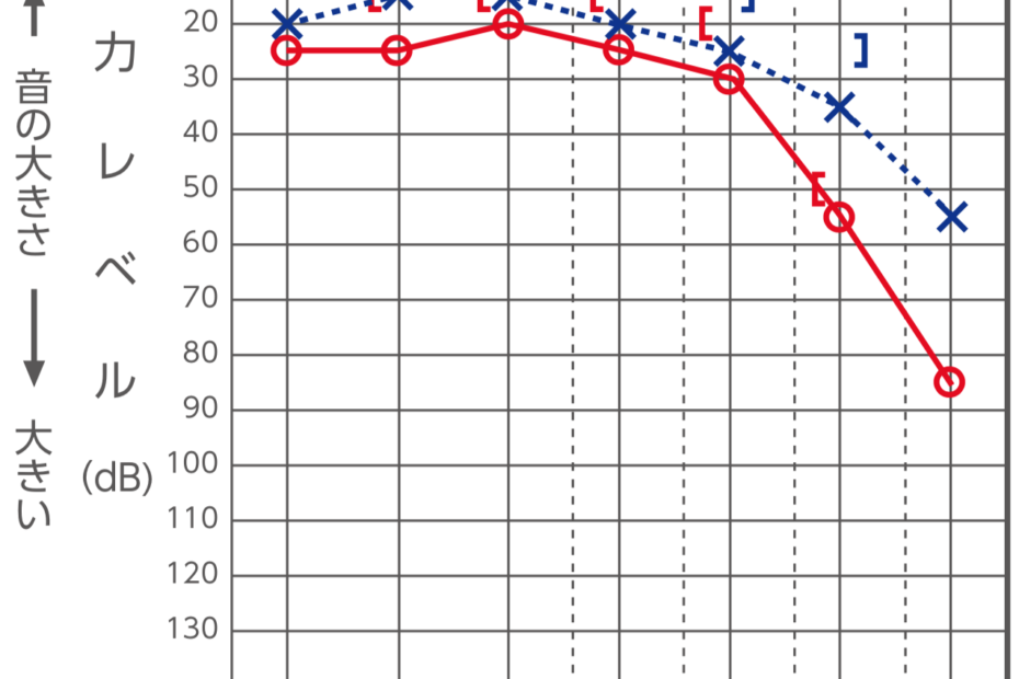 オージオグラム 記載例 成城補聴器