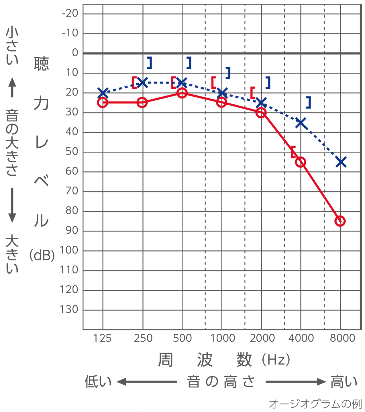 純音 聴力 検査 で 正しい の は どれ か