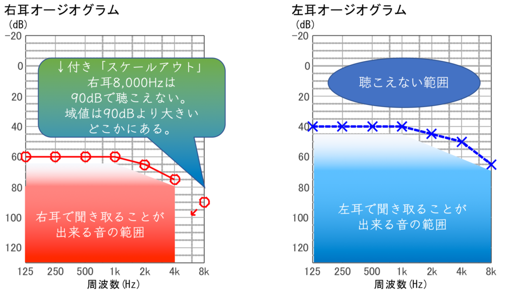 Audiogram Hearing range Seijo hearing aid