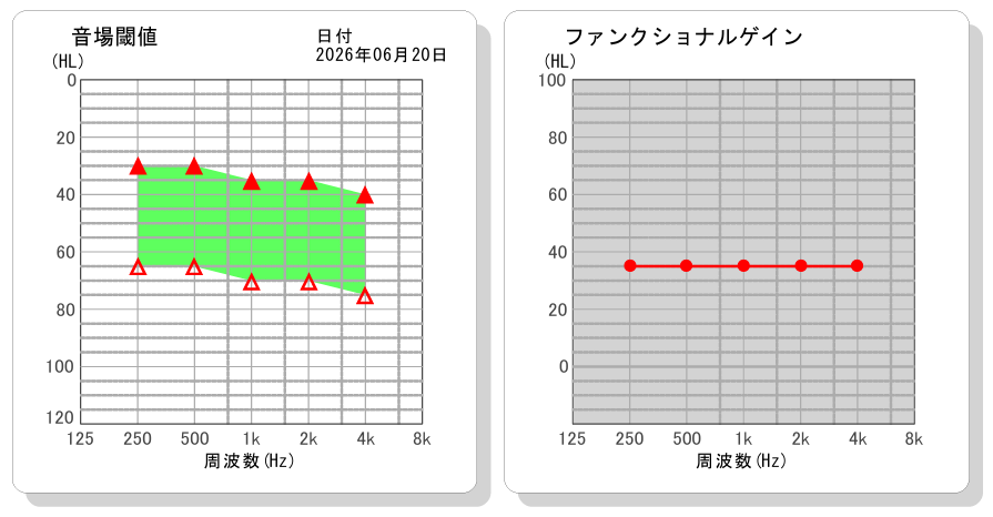オーティコン ジール Oticon Zeal 成城補聴器 音場閾値 域値